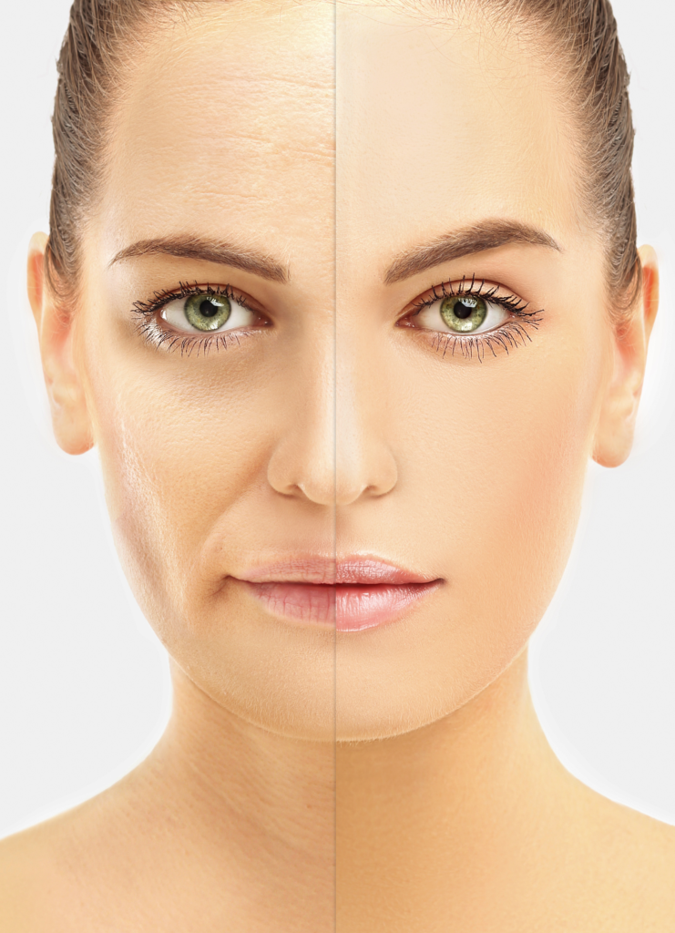 The Benefits of a Cosmetic Pharmaceutical Grade Chemical Peel ⋆ drten20